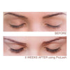 Prolash lash growth enhancer before and after effect